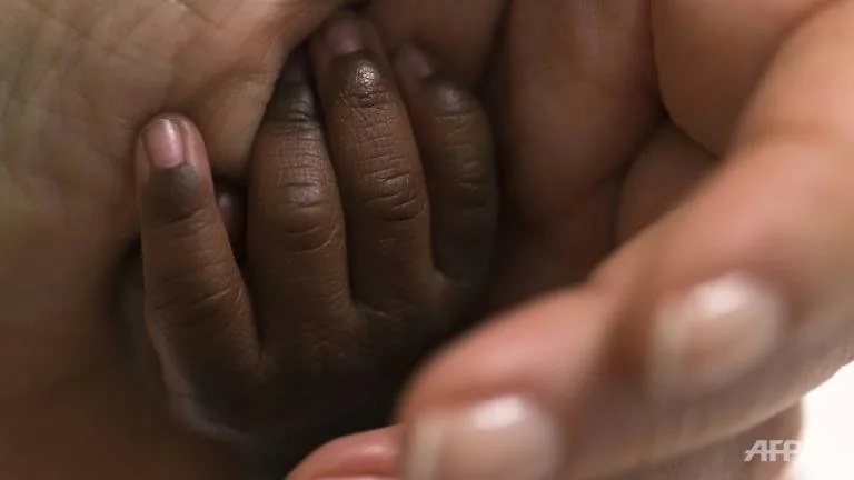 US black kids die at higher rates than white ones after surgery: Study